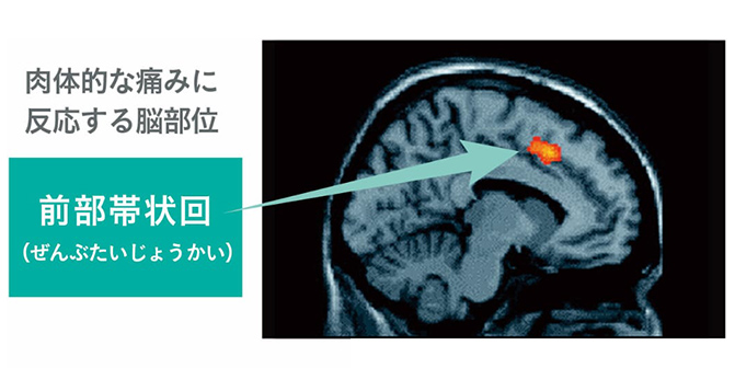 Eisenberger et al.,Science,2003